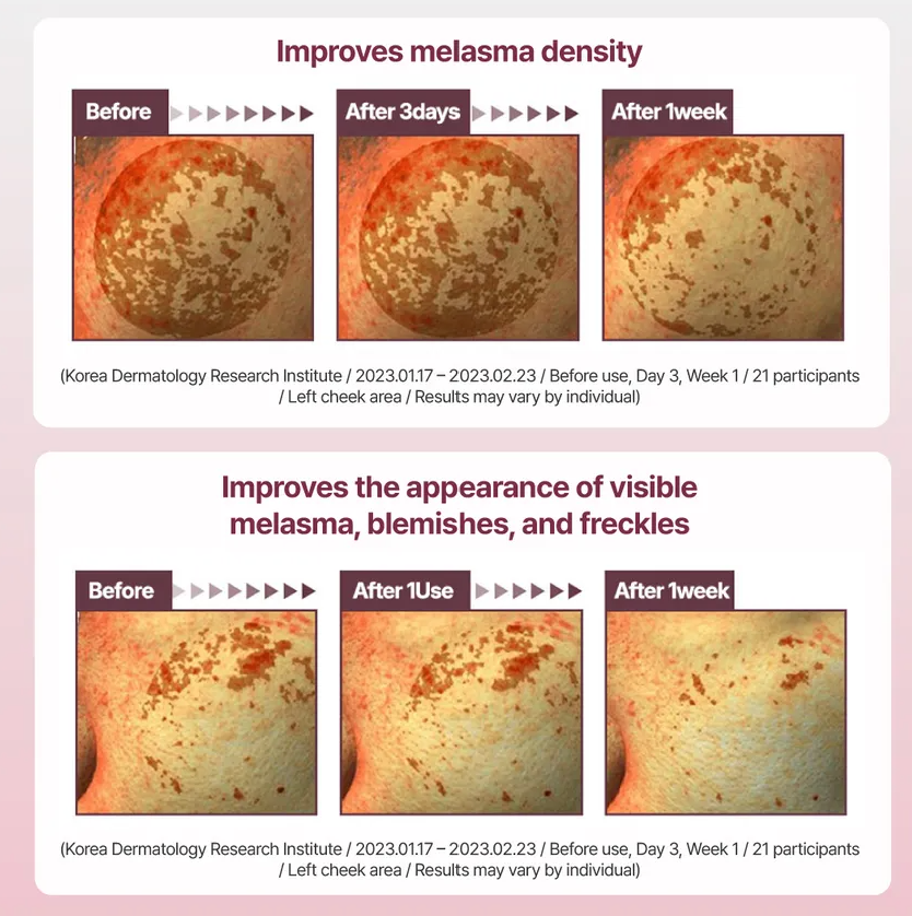 [Centellian 24] Madeca Mela Capture Ampoule Pad - TECA & Glutathione for Dark Spot Correction & Brightening (60 Pads + 60 Refill Set)